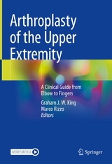 Arthroplasty of the Upper Extremity - 
