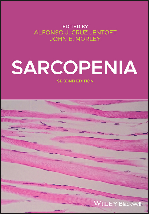 Sarcopenia - 