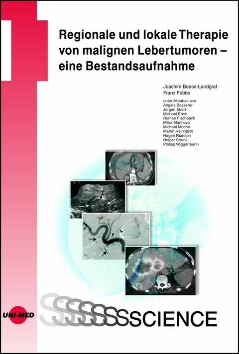 Regionale und lokale Therapie von malignen Lebertumoren - eine Bestandsaufnahme - Joachim Boese-Landgraf, Franz Fobbe