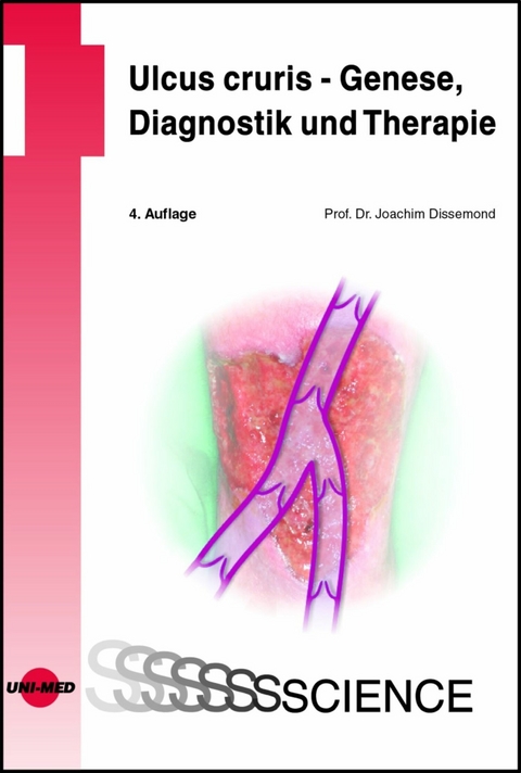 Ulcus cruris - Genese, Diagnostik und Therapie - Joachim Dissemond