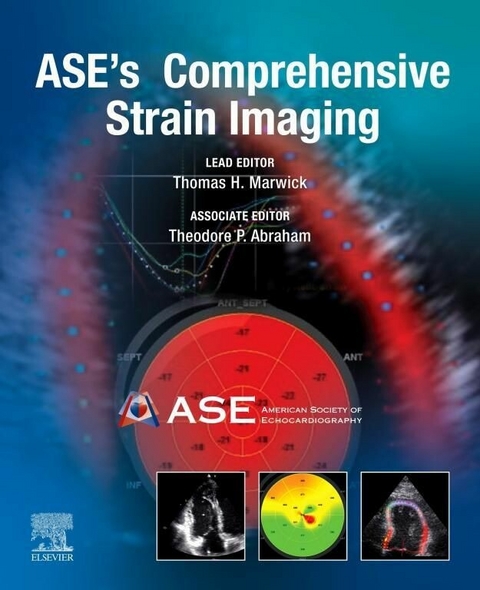 ASE's Comprehensive Strain Imaging, E-Book - 