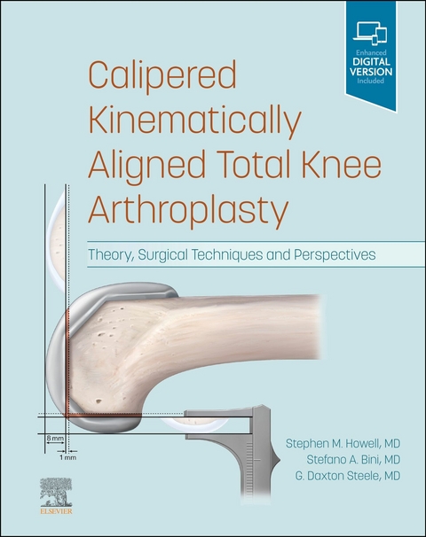 Calipered Kinematically aligned Total Knee Arthroplasty E-Book -  Stephen M. Howell,  Stefano A. Bini,  G. Daxton Steele