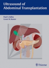 Ultrasound of Abdominal Transplantation - Paul S. Sidhu, Grant M. Baxter