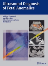 Ultrasound Diagnosis of Fetal Anomalies - Albig, Matthias; Becker, Rolf; Entezami, Michael; Gasiorek-Wiens, Adam