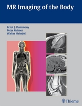 MR Imaging of the Body - 