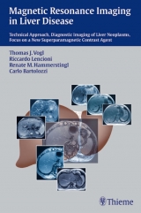 Magnetic Resonance Imaging in Liver Disease - Vogl, Thomas; Lencioni, Riccardo; Hammerstingl, Renate