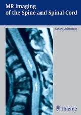 MR Imaging of the Spine and Spinal Cord - Detlev Uhlenbrock