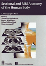 Sectional and MRI Anatomy of the Human Body - Petrović, Predrag; Vidić, Branislav; Gibo, Hirohiko; Marinković, Slobodan; Milisavljević, Milan; Schellinger, Dieter; Antunović, Vaso