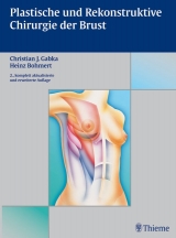 Plastische und rekonstruktive Chirurgie der Brust - Bohmert, Heinz; Gabka, Christian J.