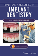 Practical Procedures in Implant Dentistry - 