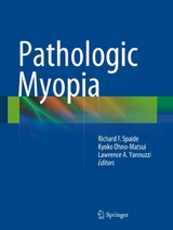 Pathologic Myopia - 