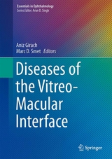Diseases of the Vitreo-Macular Interface - 