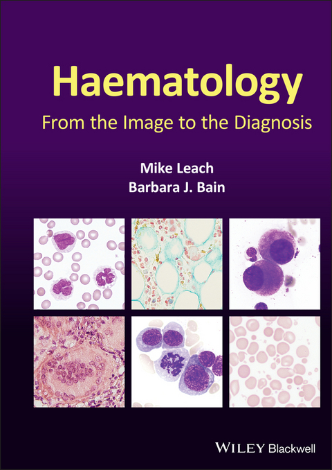 Haematology -  Barbara J. Bain,  Mike Leach