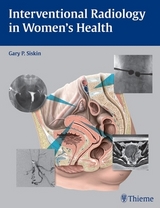 Interventional Radiology in Women's Health - Gary P. Siskin