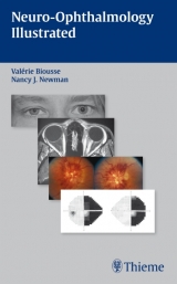 Neuro-ophthalmology Illustrated - Valerie Biousse, Nancy J. Newman