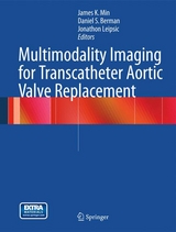 Multimodality Imaging for Transcatheter Aortic Valve Replacement - 