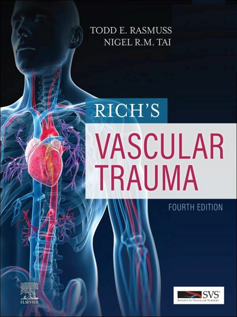 Rich's Vascular Trauma E-Book - 