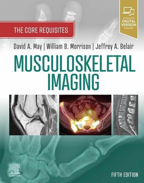 Musculoskeletal Imaging: The Core Requisites -  Jeffrey A. Belair,  David A. May,  William B. Morrison