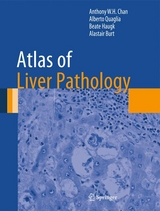 Atlas of Liver Pathology -  Alastair Burt,  Anthony W.H. Chan,  Beate Haugk,  Alberto Quaglia