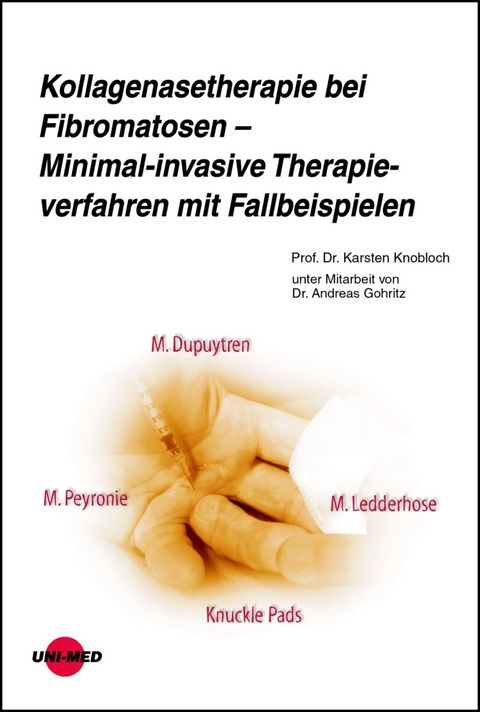 Kollagenasetherapie bei Fibromatosen – Minimal-invasive Therapieverfahren mit Fallbeispielen - Karsten Knobloch