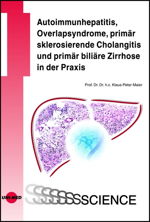Autoimmunhepatitis, Overlapsyndrome, primär sklerosierende Cholangitis und primär biliäre Zirrhose in der Praxis - Klaus-Peter Maier