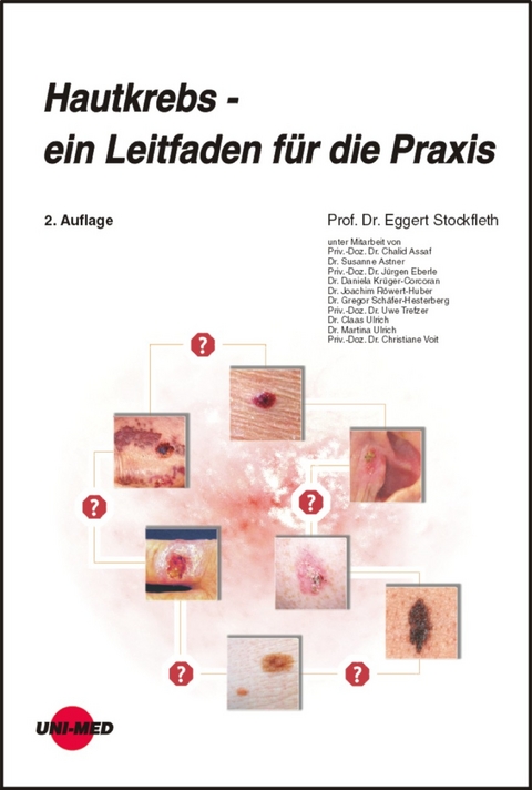 Hautkrebs - ein Leitfaden für die Praxis - Eggert Stockfleth