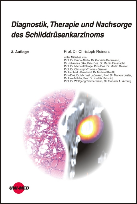 Diagnostik, Therapie und Nachsorge des Schilddrüsenkarzinoms - Christoph Reiners