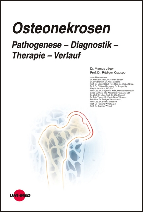 Osteonekrosen. Pathogenese – Diagnostik – Therapie – Verlauf - Marcus Jäger, Rüdiger Krausp