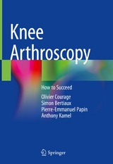 Knee Arthroscopy - Olivier Courage, Simon Bertiaux, Pierre-Emmanuel Papin, Anthony Kamel