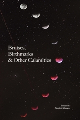 Bruises, Birthmarks & Other Calamities - Nadine Klassen