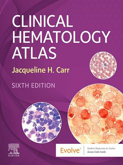 Clinical Hematology Atlas - E-Book -  Jacqueline H. Carr