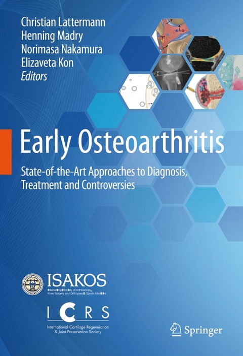 Early Osteoarthritis - 