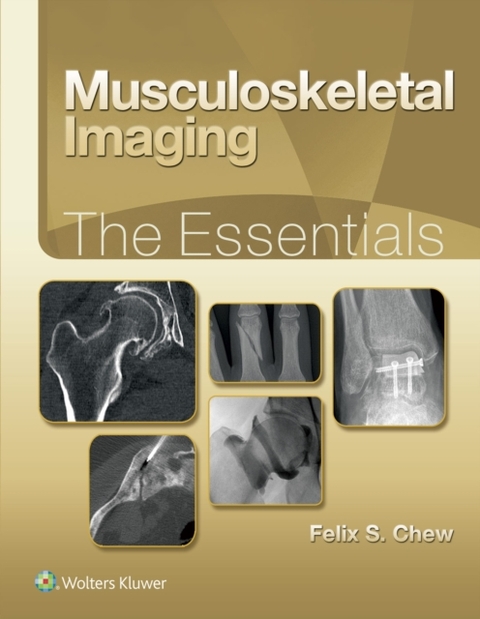 Musculoskeletal Imaging: The Essentials -  Felix S. Chew