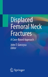 Displaced Femoral Neck Fractures - 