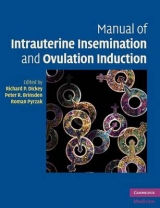 Manual of Intrauterine Insemination and Ovulation Induction - Dickey, Richard P.; Brinsden, Peter R.; Pyrzak, Roman