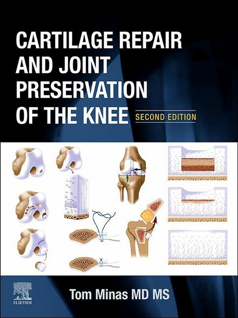 Cartilage Repair and Joint Preservation of the Knee -  Tom Minas