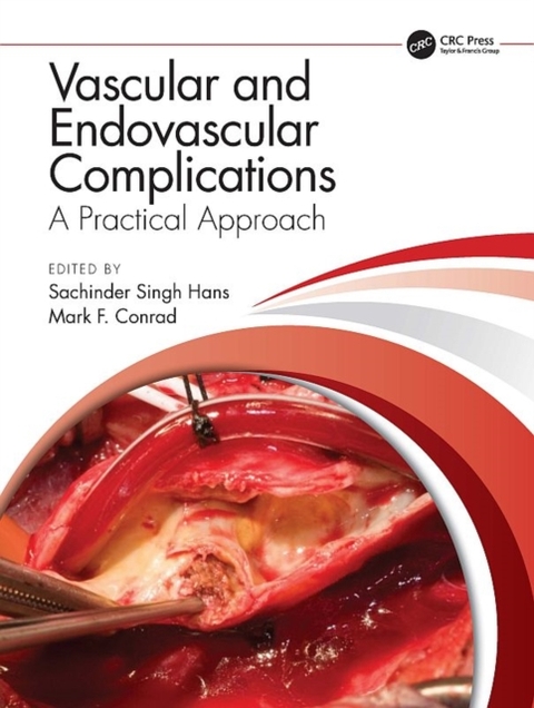 Vascular and Endovascular Complications: A Practical Approach - 
