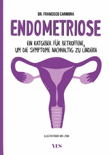 Endometriose - Francisco Carmona