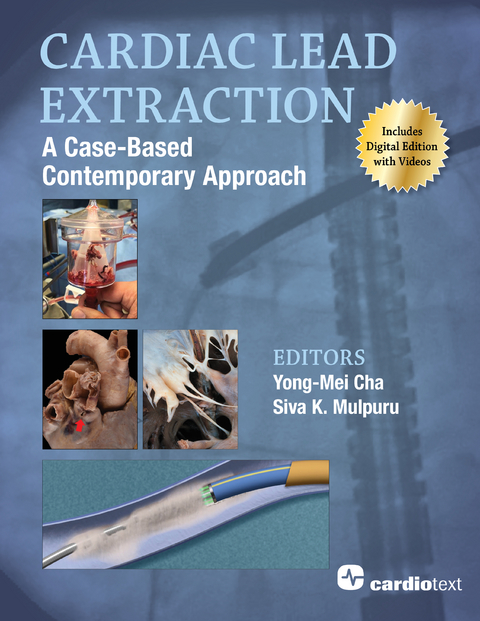 Cardiac Lead Extraction: A Case-Based Contemporary Approach - 