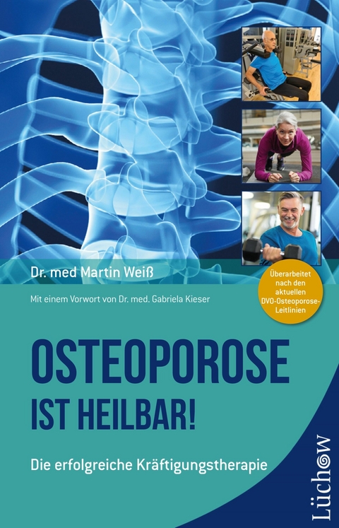 Osteoporose ist heilbar! - Martin Weiß  Dr. med.