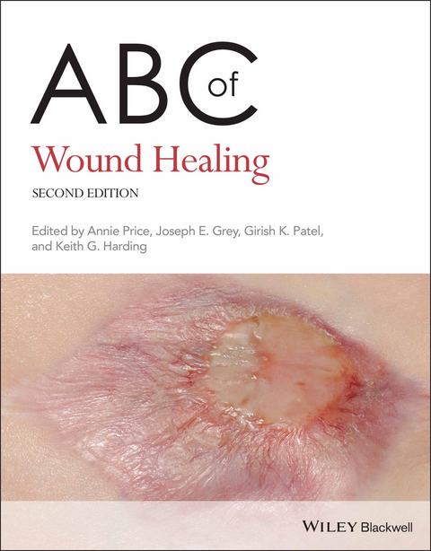 ABC of Wound Healing - 