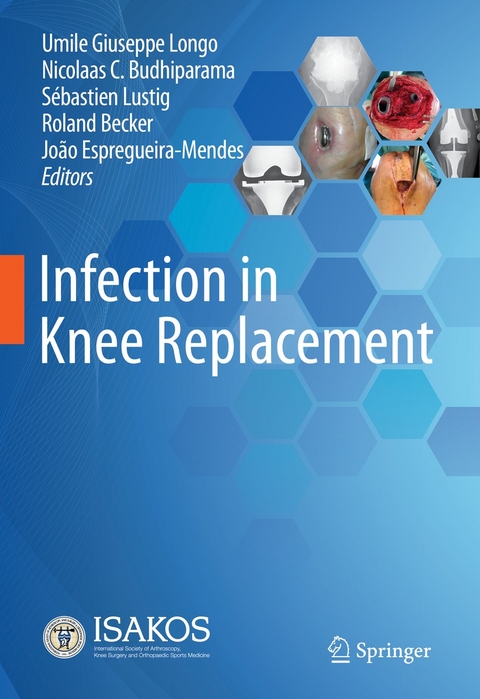 Infection in Knee Replacement - 
