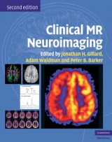 Clinical MR Neuroimaging - Gillard, Jonathan H.; Waldman, Adam D.; Barker, Peter B.