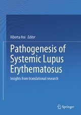 Pathogenesis of Systemic Lupus Erythematosus - 