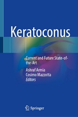 Keratoconus - 