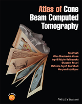 Atlas of Cone Beam Computed Tomography - Yaser Safi, Mitra Ghazizadeh Ahsaie, Ingrid Rózylo-Kalinowska, Ghassem Ansari, Mahsima Tayefi Nasrabadi, Maryam Fazlalipour