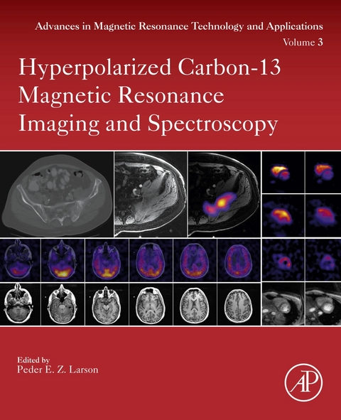 Hyperpolarized Carbon-13 Magnetic Resonance Imaging and Spectroscopy - 