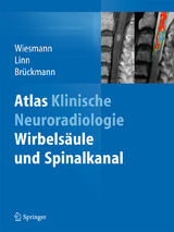 Atlas Klinische Neuroradiologie - 