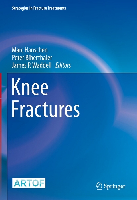 Knee Fractures - 