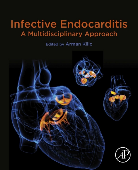 Infective Endocarditis - 